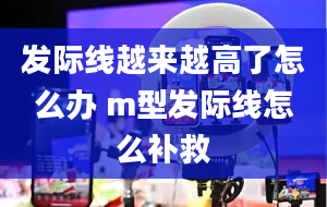 发际线越来越高了怎么办 m型发际线怎么补救